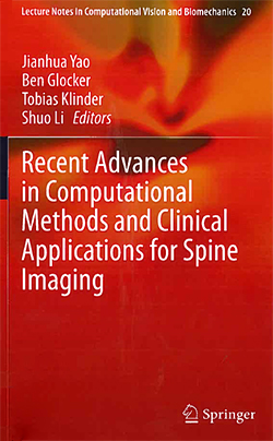 Recent advances in computational methods and clinical applications for spine imagin
